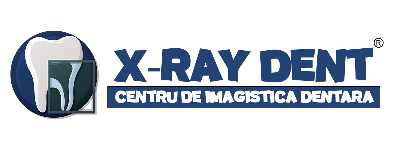X-Ray Dent