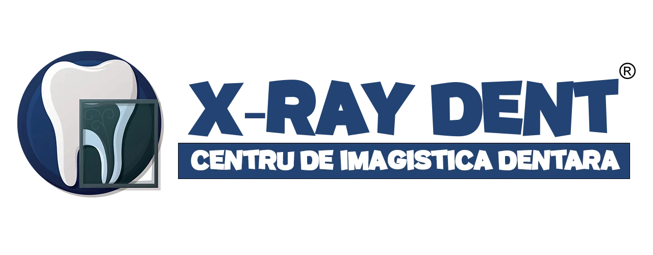 X-Ray Dent